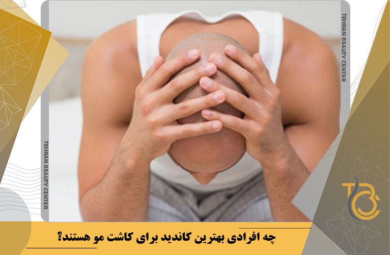 چه افرادی بهترین کاندید برای کاشت مو هستند؟