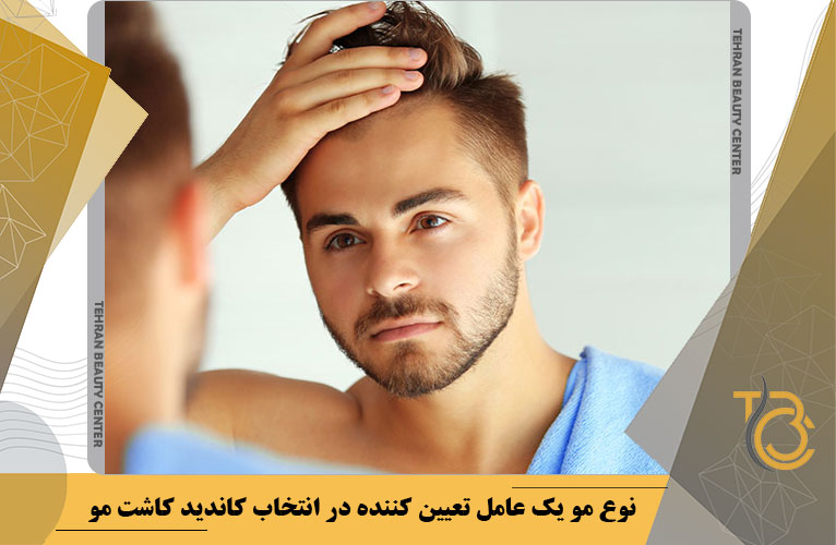 نوع مو یک عامل تعیین کننده در انتخاب کاندید کاشت مو