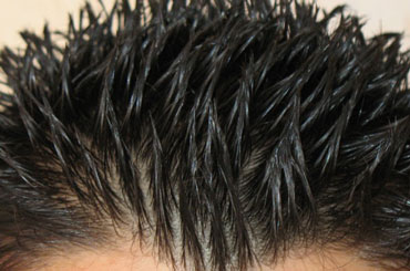 ساختار مو و مراحل رشد مو